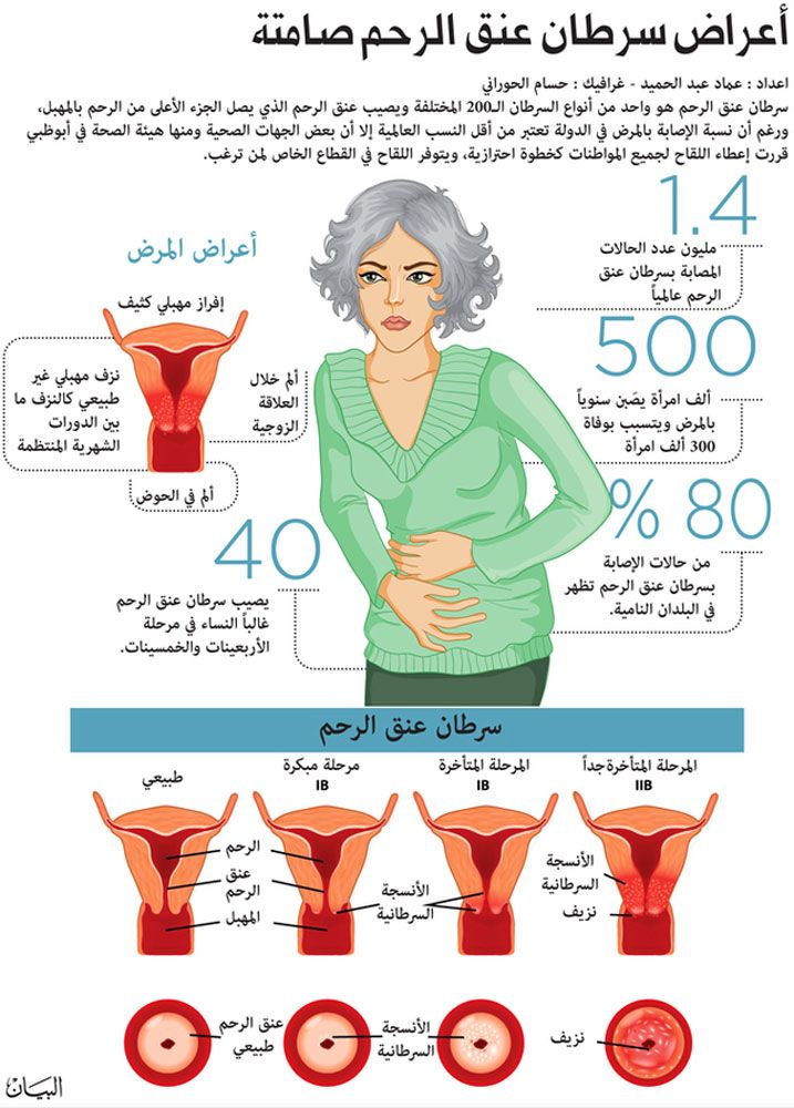 ما هي أسباب سرطان عنق الرحم