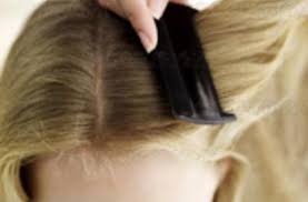 ما هو علاج قمل الشعر