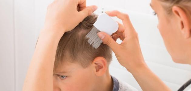 أسباب ضعف الشعر عند الأطفال