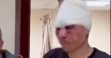 بوجه مشوه.. معتقل فلسطينى يروى تفاصيل تعذيبه على يد جندى إسرائيلى.. فيديو