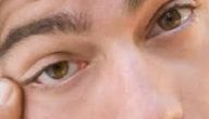 أعراض وأسباب غير شائعة لالتهابات جفن العين   حصري على لحظات